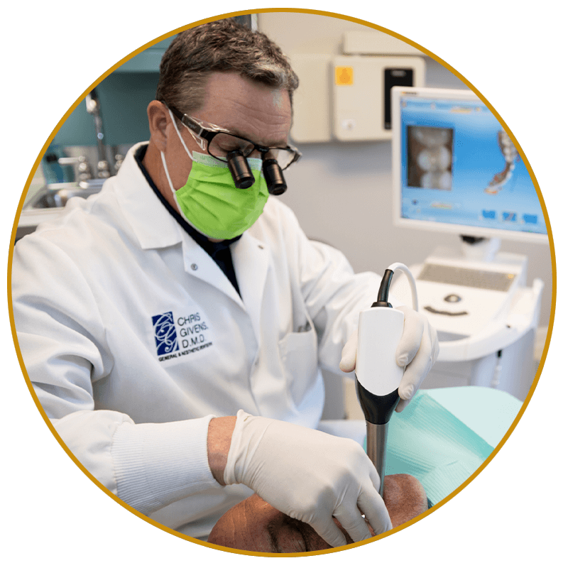 cerec scanner dr givens3