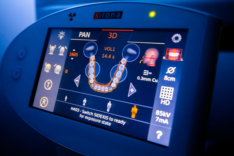 screen of dental machine showing patients teeth